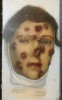Modèle anatomique humain d'un visage