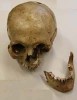 Crâne humain (avec maxillaire inférieure)